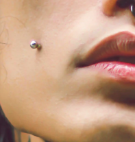 Cheek