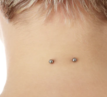 Nape