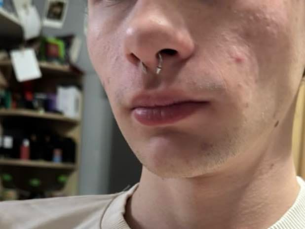 Vélemény 2 thumbnail